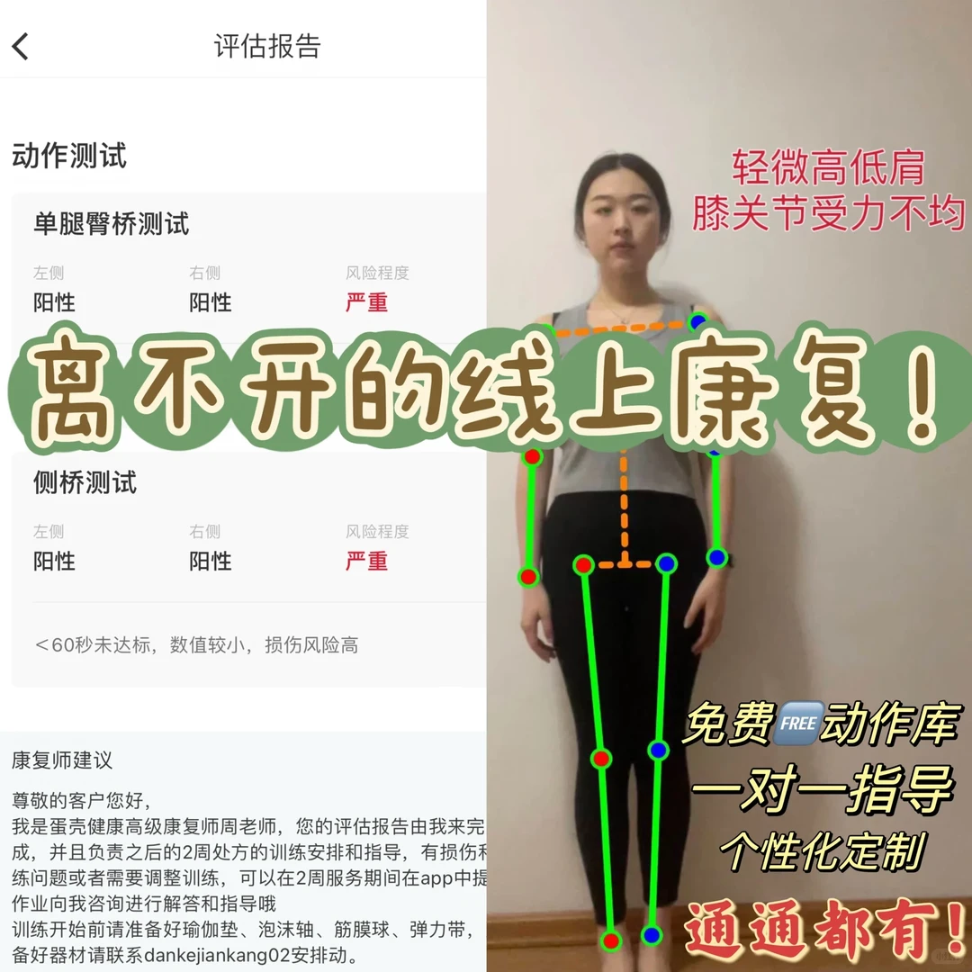 腰突康复的合理外援——线上康复指导